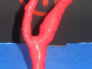 l'artère carotide irm de la biologie 3d l'anatomie l'angiographie modèle physiologie navire 3d print model - Mito3D