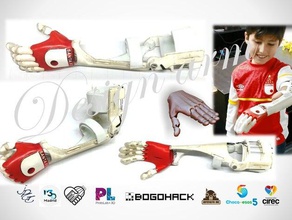 flexy-kol remix insanlar kol etkinleştirin flexy-el el protez 3d print model - Mito3D