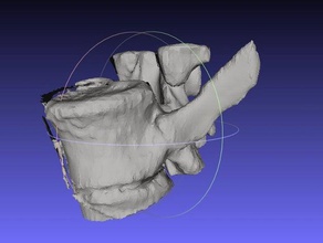 vertebra MRG mühendislik biyomedikal tıbbi mrı 3d print model - Mito3D