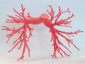 pulmonary arteries 2 piece snap-fit biology artery blood scan vessel 3d print model - Mito3D