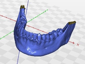 menschlichen Kiefer Biologie Unterkiefer Zähne Tomographie zahn 3d print model - Mito3D