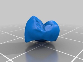 la couronne dentaire de biologie 3d print model - Mito3D