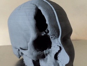 dissecados cabeça crânio ressonância magnética varreduras réplicas 3dscan 3d print model - Mito3D