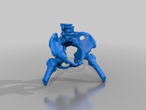 fractured pelvis buildings structures bone orthopedics surgical simulation 3d print model - Mito3D