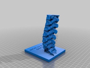 elahd bar-shais lumbar spine biology body bones ct scan human medical mri 3d print model - Mito3D