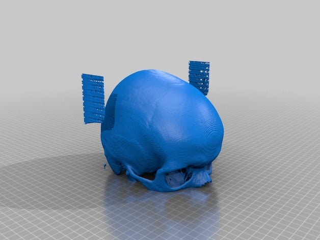 half cranium biology 3D print model - Mito3D