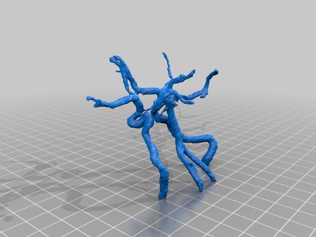 artères du cerveau biologie 3D print model - Mito3D
