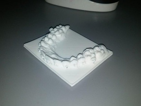 diş telleri dişi insanlar vücut hekimi insan vücudu çene oral ortho ortodonti ameliyat upperjaw vücudunuzun 3d print model - Mito3D