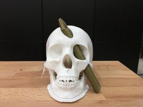 phineas gage skull biology 3d print model - Mito3D