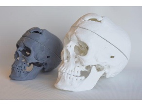 skull phineas gage biology artifact education historical human museum neuroscience skulls stem 3d print model - Mito3D