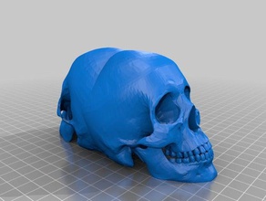 conjoined human skull 3d printing 3d print model - Mito3D