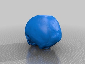 skull ct scan 3d printing 3d print model - Mito3D