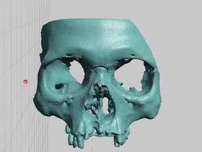 partial human skull african ancestry facial region scan scans replicas anatomy anthropology archaeology face 3d print model - Mito3D