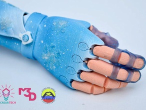 regina della neve flexy braccio ii attivare persone protesi 3d print model - Mito3D