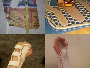 wrist brace 5th metacarpal fracture bracelets orthotics wristbrace 3d print model - Mito3D
