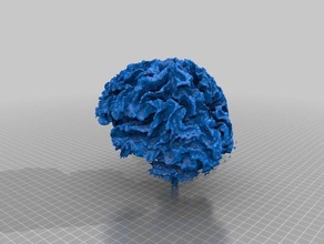 certified insane persons brain ---mine scans replicas medical scan mri 3d print model - Mito3D