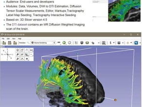 druckbare diffusion mri-Analyse Gehirn Bahnen Biologie 3d print model - Mito3D