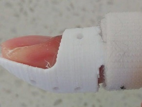 stack splint mallet finger injury other 3d print model - Mito3D