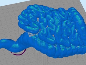 intestino altri 3d print model - Mito3D