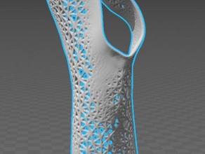 orthèse de poignet d'autres l'anatomie corps os l'éducation d'enseignement coude la main l'aide coup mains humain médicaux l'ergothérapie l'orthopédie orthèses thérapie physique attelle 3d print model - Mito3D