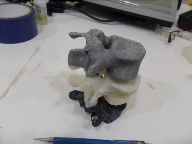 lombar vertebra l3 l4 l5 biyoloji kemikler ct taraması tıbbi Ortopedi omurga 3D print model - Mito3D
