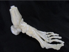 ankle talus fracture biology feet medical orthopedics 3d print model - Mito3D