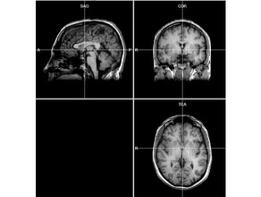 humanos reais hemisfério esquerdo biologia anatomia cérebro médica neurociência 3d print model - Mito3D
