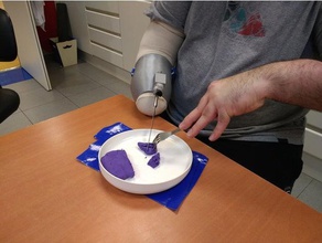 brazalete funzionali para amputado eess amputato braccio funzionale la terapia occupazionale protesis protesi ocupacional 3d print model - Mito3D