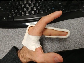 finger splint biology broken medical devices 3d print model - Mito3D