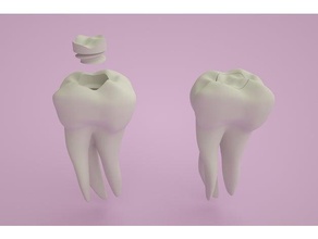 tooth fairy box 3d print model - Mito3D
