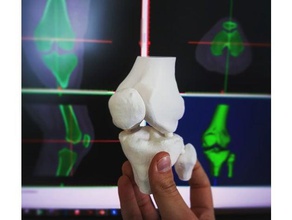 la rodilla de tomografía computarizada biología anatomía humanos 3d print model - Mito3D