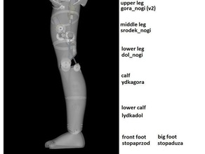 damiano gambe inmoov - parti alte diviso due modello di robot 3d print model - Mito3D