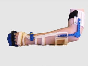 arejado braço de 2015 pessoas dispositivo assistencial órteses prótese 3d print model - Mito3D