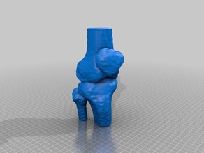 knee joint medical model 3d print model - Mito3D