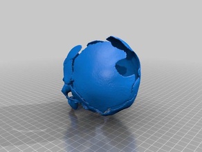 displasia fronto biologia cranio umano 3d print model - Mito3D