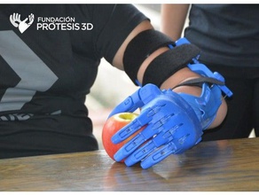 unlimbited fp3d 3d baskı kol etkinleştirin protez 3d print model - Mito3D