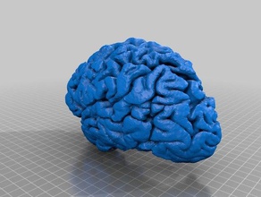 brain mri 3d printing brains medical medicine parametric 3d print model - Mito3D