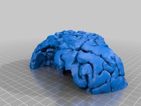 mri do cérebro tumor médica dispositivos médicos medieval 3d print model - Mito3D