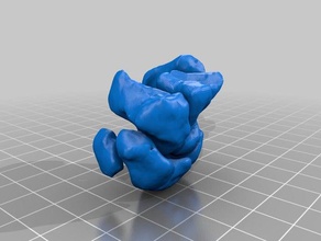 wrist ct scan 3d printing 3d print model - Mito3D