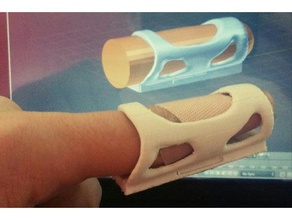 finger splint organically inspired style 3d printing 3d print model - Mito3D