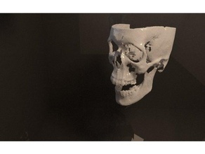 ben engel tc exprt biologia cone beam ct dicom mediche effettuate cranio 3d print model - Mito3D