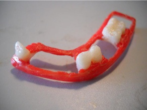 dental-Teilprothesen 3d print model - Mito3D