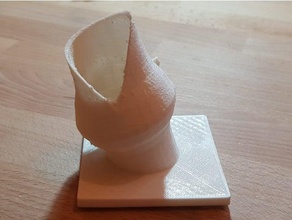 surgical aortic valve model biology 3d print model - Mito3D