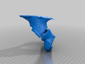 fratura do acetábulo anatomia quadril pelve 3d print model - Mito3D