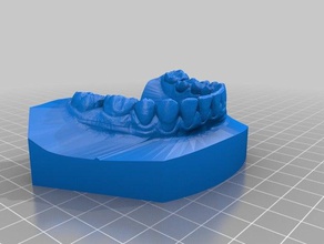real teeth scans & replicas mouth orthodonticmodel 3d print model - Mito3D