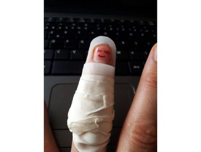 finger splint hand tools 3d print model - Mito3D