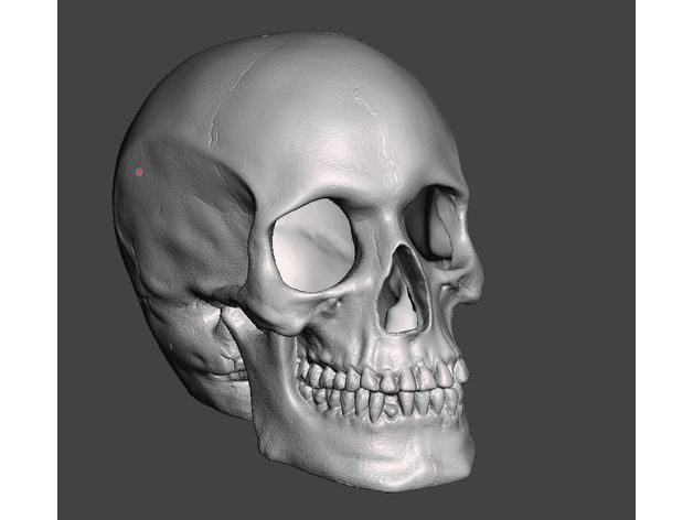 hollow skull w shattered occipital bone scans & replicas human 3D print model - Mito3D