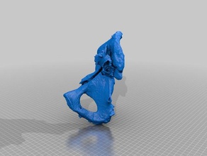 fratura no quadril 3d impressão 3d print model - Mito3D