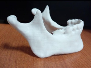 la segmentación de médicos mandíbula mandibulajaw otros 3d print model - Mito3D