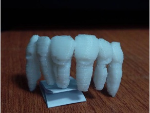 dental otros 3d print model - Mito3D